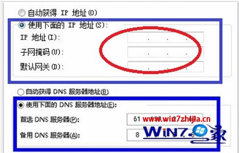 设置固定ip